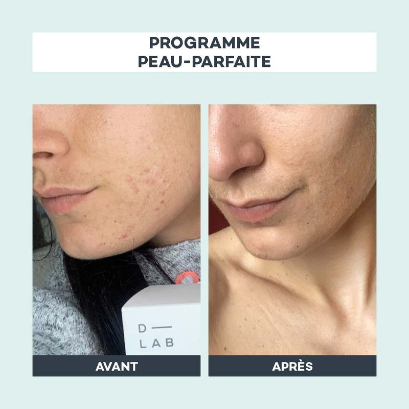 Peau-Parfaite