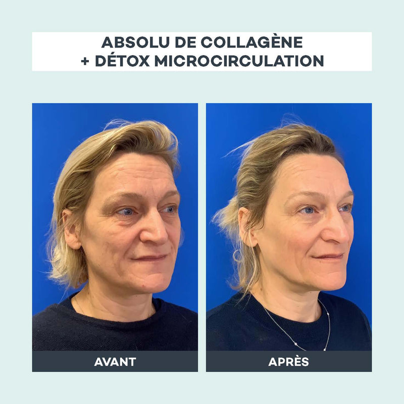 Absolu De Collagène
