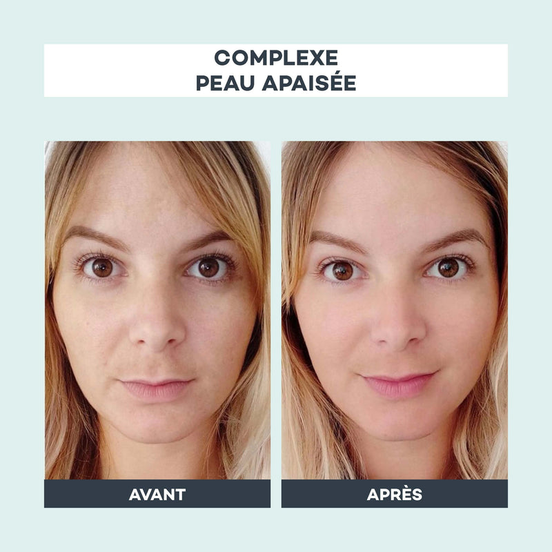 Complexe Peau Apaisée
