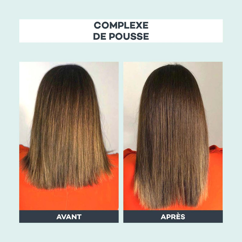 Complexe de Pousse