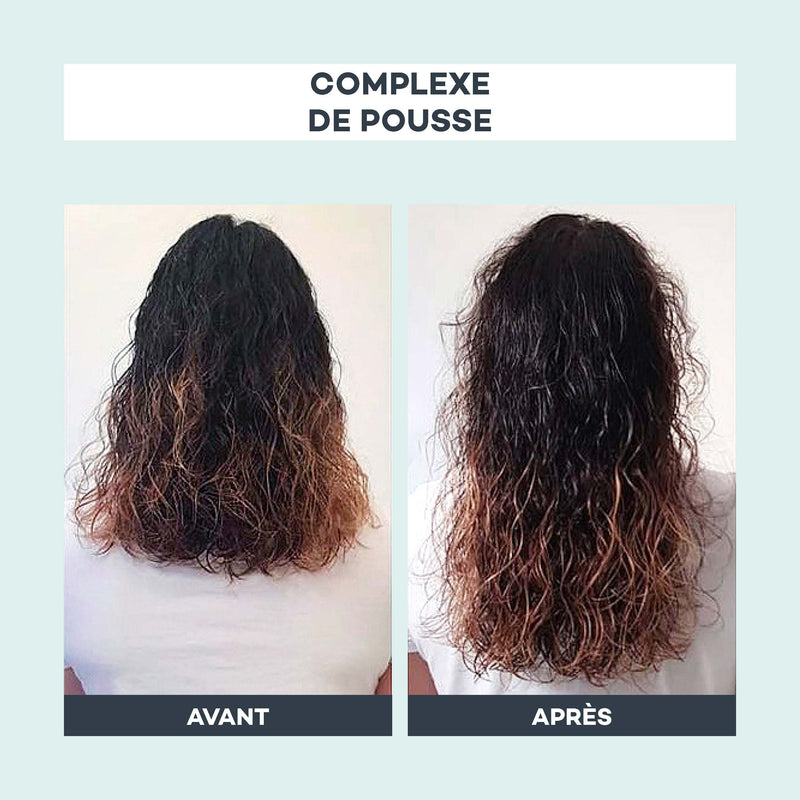 Complexe de Pousse