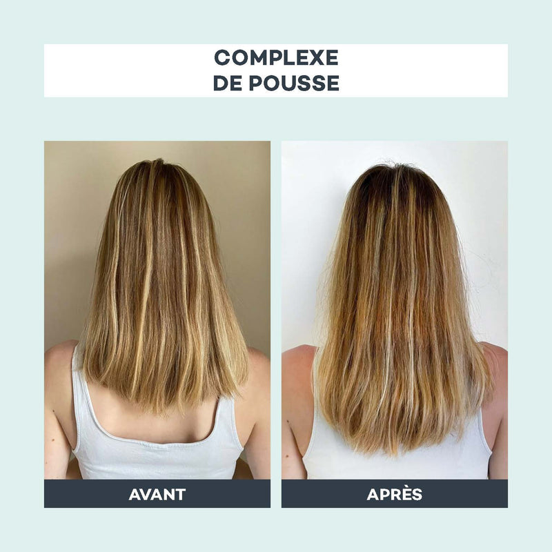 Complexe de Pousse
